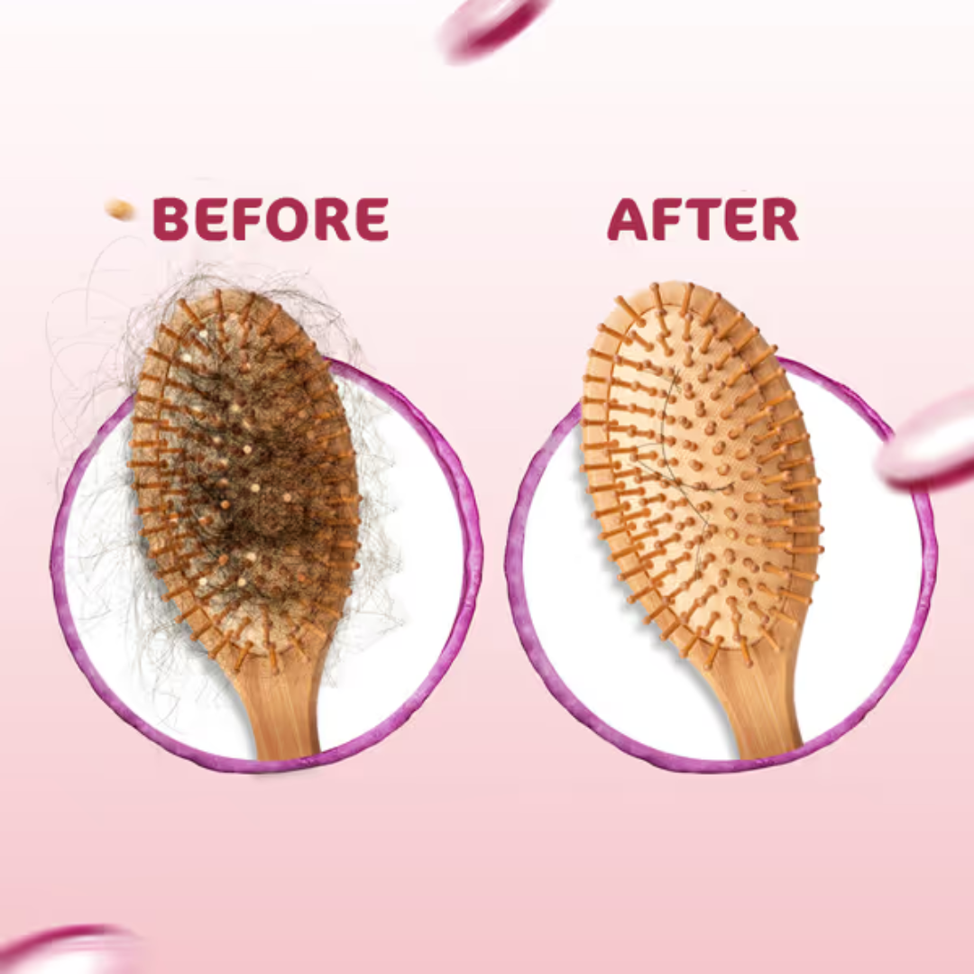 Onion Oil for Hair Growth by Prokare